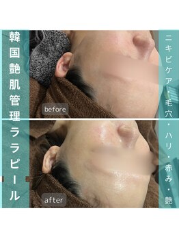 サロン ドゥメール(salon Demaile)/韓国女優みたいな水光・艶肌に☆