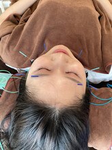 ハリファ鍼灸院 横浜関内院(HariFa鍼灸院)/美容施術