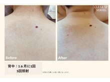 サロン ルアナ(salon luana)/手の届かない背中もお任せ◎