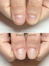 マリーロール 淀屋橋本店(Marie Laure)/自爪育成/深爪矯正/ネイルケア
