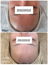 ムム(mumu)/水分量が増え若々しいお肌に！