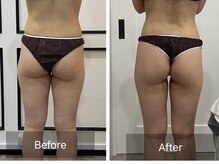 トータルビューティ リライフ(Total beauty Relife)/ウルトランス１２０分全身ケア