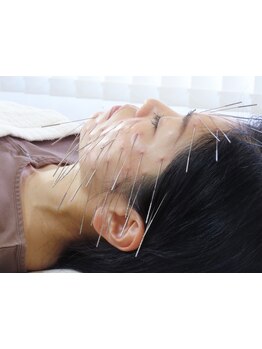 小顔になりたい