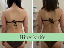 ソルニスデュオ(Solnis.-duo-)/痩身/酵素浴/毛穴/よもぎ蒸し