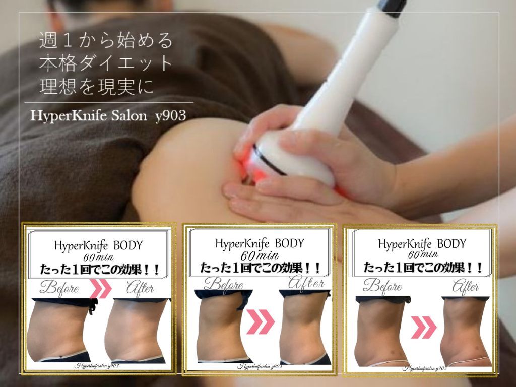 ワイキューマルサン(y903)｜ホットペッパービューティー