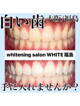 ホワイトニングサロン ホワイト(WHITE)/白い歯手に入れませんか？