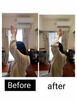 アース エンジェル整体院/ビフォアフ　肩こり　ストレッチ