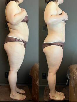 ステラ(Stella)/筋肉を正しく整えると変わる！