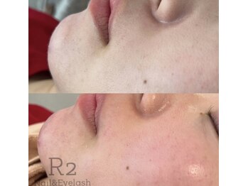 アイラッシュサロンアールツー(eyelash salon R2)/フェイスWAX