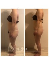 レガリア(LEGAREA)/