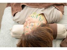 北梅田美容鍼灸院/【大阪/梅田】美容鍼灸