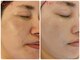 サロンドットブレスドットケイ(salon.bless.k)の写真