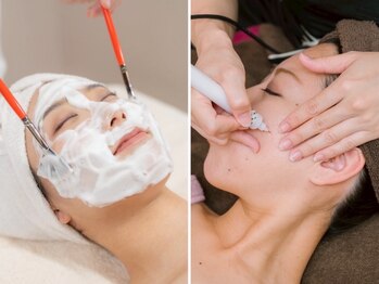 ピュアボディ(Pure Body)の写真/剥かないピーリングで水光肌♪【シミケア体験+ララピール★¥6400】疲れ顔・くすみも一掃!若々しい印象へ