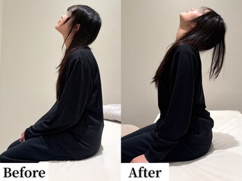 ソレア(Solea)/首こり・肩こり改善1回目