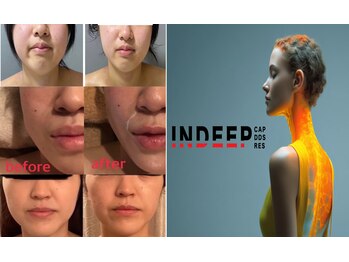 アム ビューティー アンド ソラニン(AMu Beauty & Soranin)/フェイシャル/INDEEP