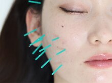 ライフサロン 恵比寿(Life Salon)の雰囲気(お顔のツボを刺激し年齢による悩みにもアプローチ!)