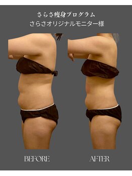 ナチュラル ビューティー スタイル さらさ(Natural Beauty Style)/痩せにいカチカチ二段腹タイプ