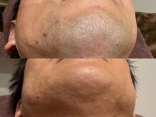 アテ 古波蔵店(ATE)