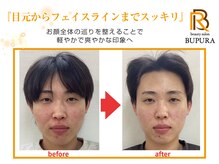 ブプラ つくば店(BUPURA)/before→after　９