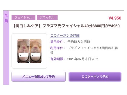 メルシートータルビューティー(MERCI)の写真