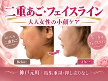 ハッテンビューティーパーク 神戸店(Hatten Beauty Park 810)