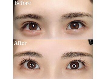 レピア 高槻店/韓国式LEPIA Before&After