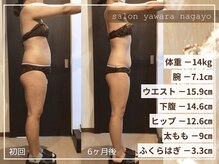 ヤワラ 長与店(yawara)/ハイパーナイフBefore After