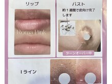 リリー(Lily)の雰囲気（♪話題のローマピンク♪100％天然成分黒ずみメラニン除去）