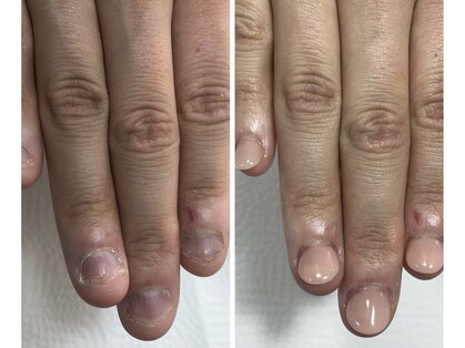 ネイルアンバー 西向田店(Nail amber)の写真