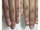 ネイルアンバー 西向田店(Nail amber)の写真