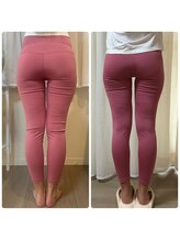 フォルスボーテ(Force Beaute)/骨盤調整で美尻に！美容整体