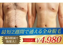男性の毛質もとことん脱毛！効果と実績を是非ご覧ください！