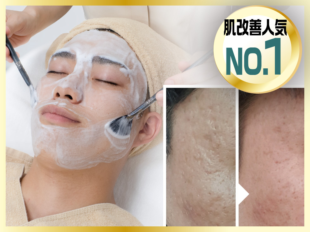 【肌質改善No.1】韓流ララピールでつるんと清潔感UP 50分¥26,400→¥9,900