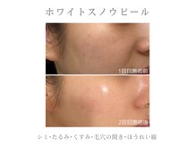 アデージョ アデオス(Ade-jyo.Adeosu)