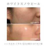 アデージョ アデオス(Ade-jyo.Adeosu)