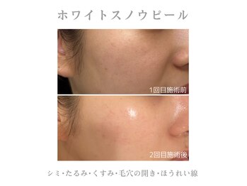 アデージョ アデオス(Ade-jyo.Adeosu)