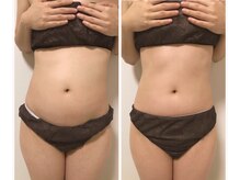 リズビー(Lisbe)の雰囲気（before＆after）