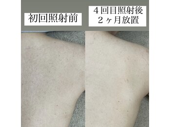 テンパ ビューティー(+10%beauty)/効果写真