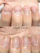 マリーロール 淀屋橋本店(Marie Laure)/自爪育成/深爪矯正/ネイルケア