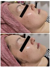 シュガー(Sugar...iyr)/プラズマニア