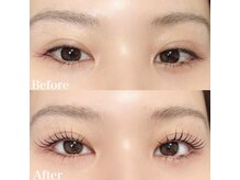 レピア 高槻店/韓国式LEPIA Before&After