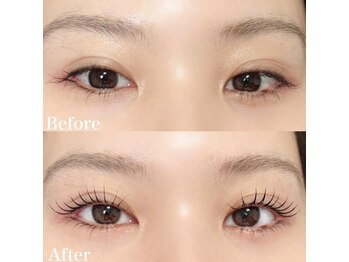 レピア 高槻店/韓国式LEPIA Before&After