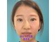 ネクスフィット(Nexfit)の写真