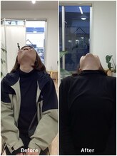 すまいむ整体院/首の症状