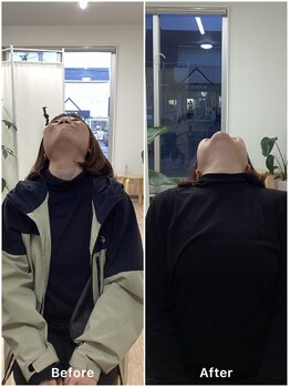 すまいむ整体院/首の症状