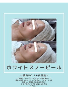 ソワナ(soina)/【神楽坂駅/フェイシャル/毛穴】