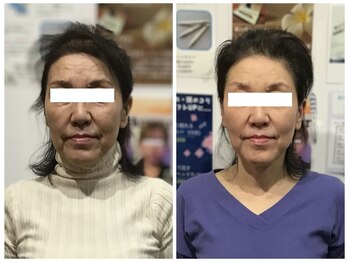 シンメトリー 麻布十番/Before/After