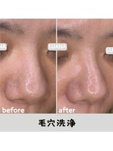 ルアナ 北谷店/毛穴洗浄毛穴ケア 《沖縄/北谷》