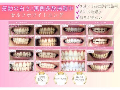 エクシアホワイトニング 名古屋名駅店の写真