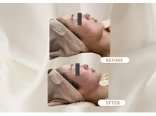 トロワ(TROIS)/深部まで熱が届くから